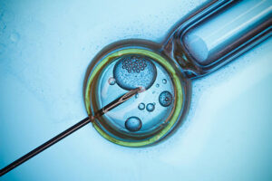 In vitro fertilizations, IVF macro concept